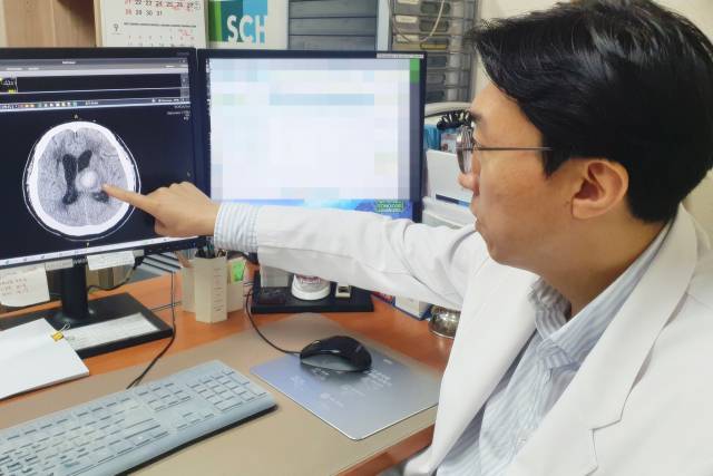 양영순 순천향대천안병원 신경과 교수가 치매 예방의 중요성에 대해 설명하고 있다. 사진 제공=순천향대천안병원