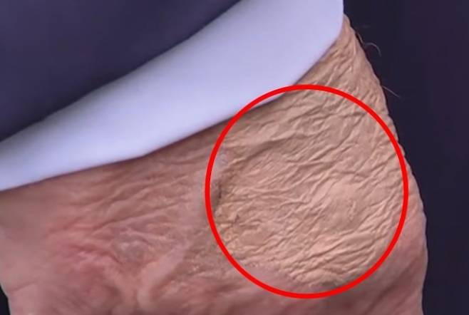 현지시간으로 15일 백악관에서 기자들과 만난 트럼프 미국 대통령의 손에서 짙은 화장 자국이 발견됐다. 데일리메일 제공