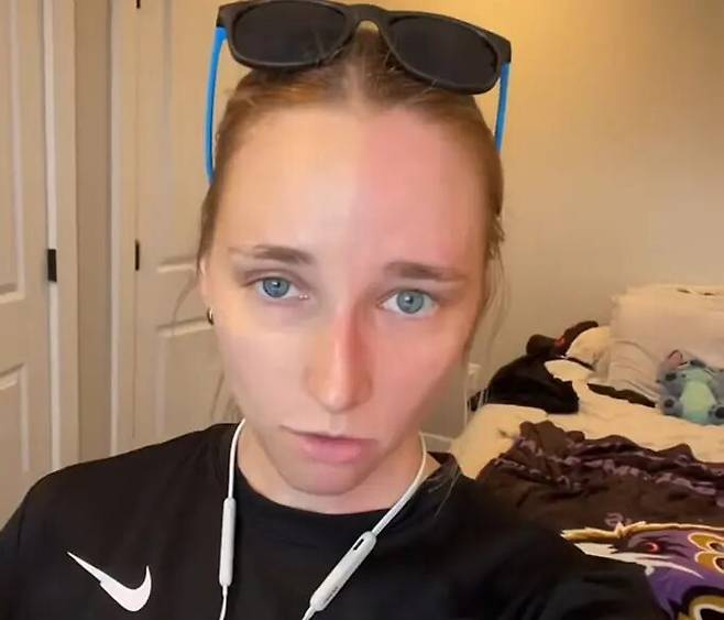 할리퀸 증후군이란 얼굴 반쪽만 홍조가 생기고 땀이 나는 병이다. 운동 후 신체가 뜨거워지거나 감정이 격해지는 상황 등에 증상이 심해질 수 있다. [사진=SNS]