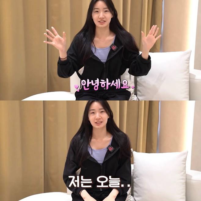 1753149026.jpg 성형 후기