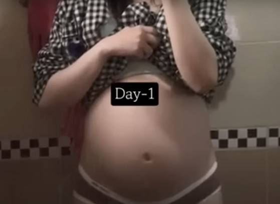 권씨는 지난해 6월 브이로그 영상을 통해 36주차 태아를 낙태하는 모습을 공개했다. 유튜브 캡쳐