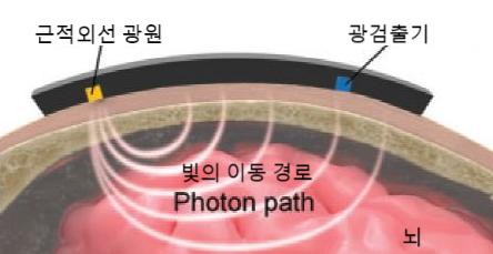이마에 부착한 무선 근적외선 분광기가 두개골을 투과한 근적외선 광선을 통해 내부 수분량과 노폐물 세척 정도를 측정하는 방식을 묘사한 모식도. 분당서울대병원 제공