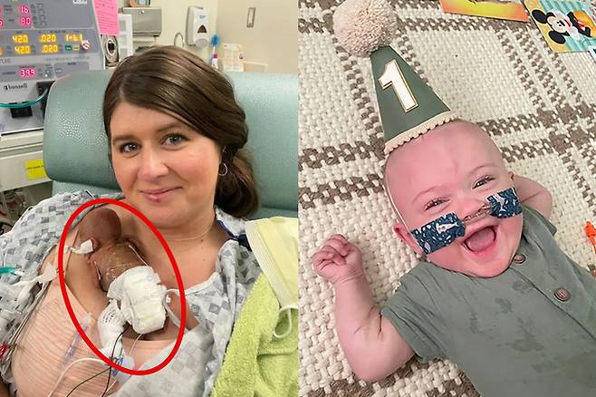 '세계에서 가장 빨리 태어난 아기' 내쉬 킨의 생후 1개월차 모습와 현재 모습. 사진=몰리-랜달 킨 부부/AP