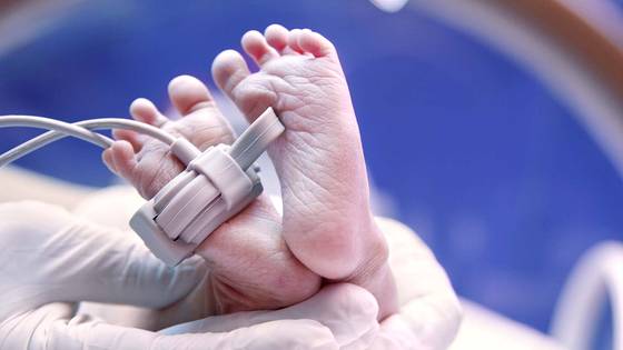 병원과 최씨 측은 양측 모두 항소를 검토하고 있다. 신생아 발 사진지료. 셔터스톡