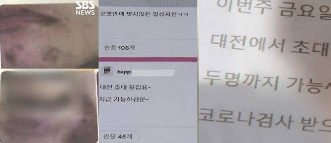 B씨가 남편으로부터 폭행을 당한 뒤 찍었다고 주장한 증거 사진(왼쪽), 남편 A씨가 온라인에서 남성들을 모집한 글. 출처=SBS뉴스 갈무리