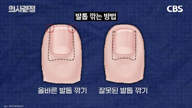 210정형외과의원 최준하 원장. '의사결정' 유튜브 캡처