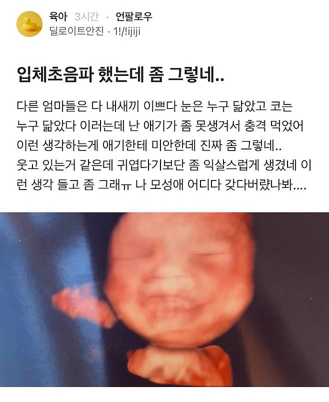 IMG_5554.jpeg 입체 초음파 했는데 좀 그러네