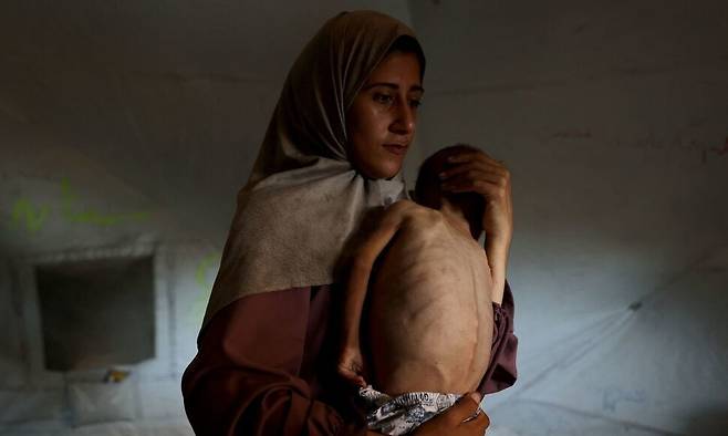 지난 24일(현지시각) 31살의 팔레스타인 여성 히다야가 가자북부 가자시티의 서쪽 샤티 난민 캠프 텐트 안에서 영양실조 증상을 보이는 18개월 된 아들을 안고 있다. 가자시티/AFP 연합뉴스