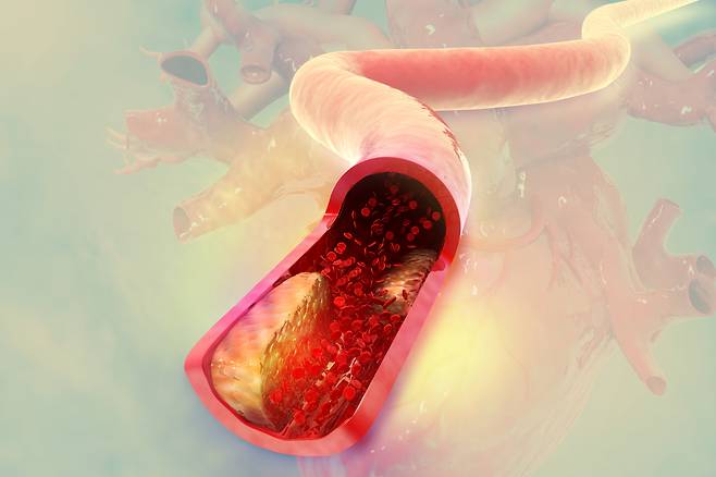혈관 노화를 늦추려면 건강한 생활 습관 유지를 통한 예방적 전략이 필수다. 우선 걷기, 달리기, 자전거 타기 등의 유산소 운동은 혈관 내피세포의 기능을 개선시키고 혈관 탄력성 유지에 중요한 역할을 한다. 나아가 산화적 스트레스와 만성 염증을 감소시킨다.<사진출처:게티이미지뱅크>
