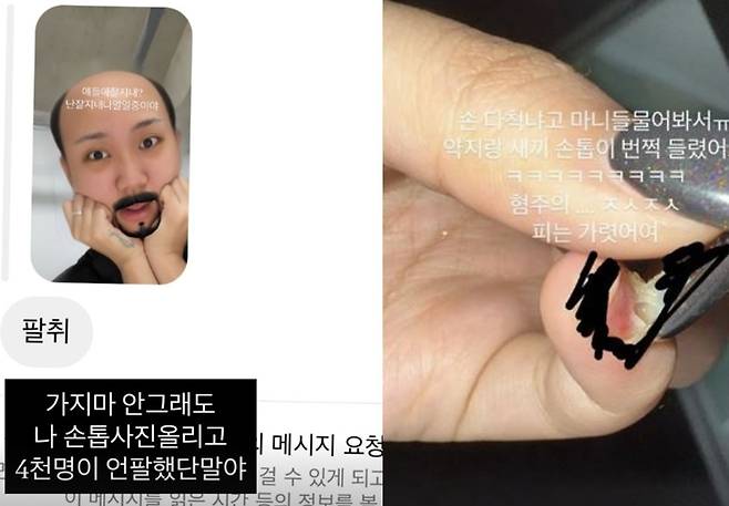 가수 이영지가 SNS(소셜미디어) 팔로워 4000명을 잃었다고 밝혔다. /사진=이영지 SNS