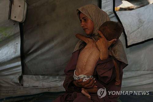 가자지구에 닥친 굶주림  [AFP=연합뉴스. 재판매 및 DB 금지]