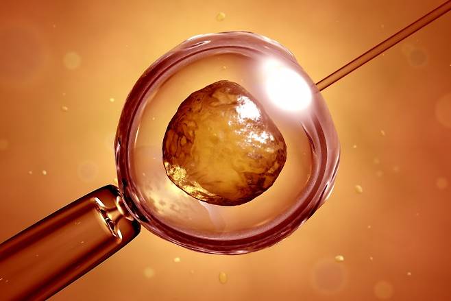 체외수정(IVF)은 몸 밖에서 난자와 정자를 수정시킨 뒤 자궁에 이식해 임신하는 방법이다. 게티이미지뱅크 제공