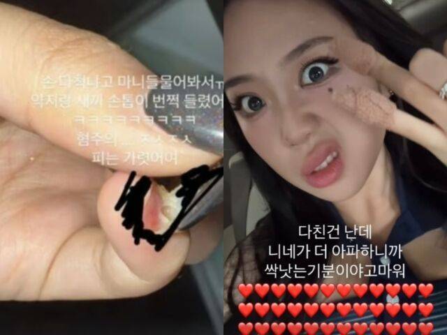 가수 이영지가 자신의 SNS에 업로드 한 사진 / 이영지 인스타그램 캡처