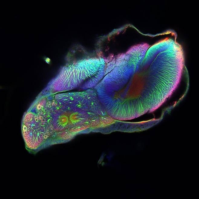 변태 과정에 있는 나비의 뇌. Amaia Alcalde Anton / Wellcome Photography Prize 2025