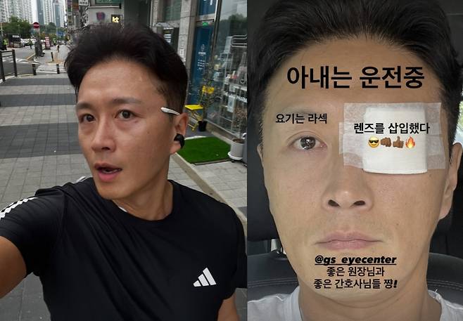 진태현이 갑상선암(갑상샘암) 완치 한 달 만에 렌즈 삽입술을 받았다. /사진=인스타그램 갈무리