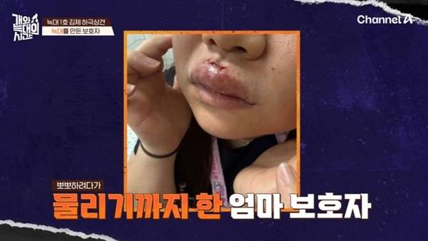 채널A ‘개와 늑대의 시간’ 캡처
