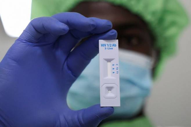 HIV는 후천성면역결핍증후군(AIDS·에이즈)을 일으키는 바이러스다. HIV 바이러스 감염자가 면역 결핍이 심해져 합병증이 생기면 에이즈 환자가 된다. 로이터·연합뉴스