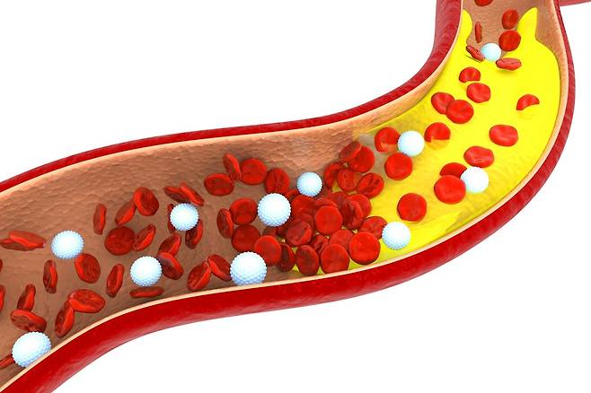 식단과 생활습관을 점검해 젊은 혈관을 위한 실천을 시작해보자. 게티이미지