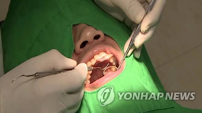 치아 치료 치주염 [연합뉴스TV 캡처]