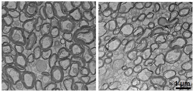 리튬 결핍은 정상 쥐(왼쪽)에 비해 신경 세포를 감싸고 있는 수초(오른쪽)를 얇게 만들었다. Yankner Lab 제공