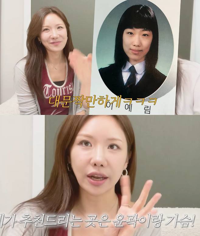 개그우먼 연예림이 자신이 받은 성형 수술을 솔직하게 밝혔다. /사진=유튜브 영상 갈무리