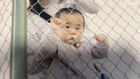 요코야마는 태어날 때부터 왼손에 손가락이 없었다. NHK 캡처
