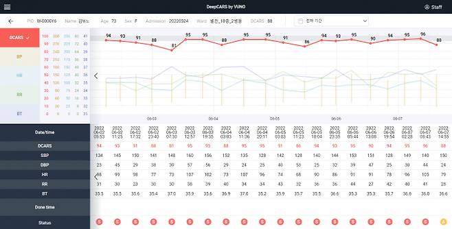 사진은 딥카스 운영화면 예시. /사진=뷰노