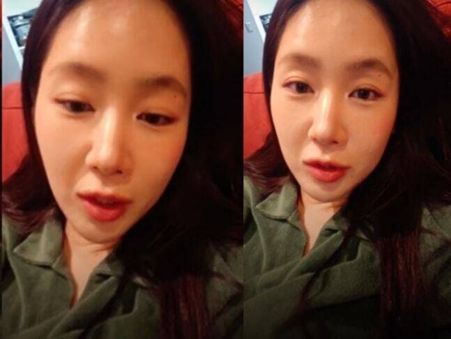 소유가 지난 7월 22일 자신의 SNS 라이브 방송을 통해 최근 불거진 자신의 성형설에 대해 해명하고 있다. 소유 SNS 라이브 방송 캡처