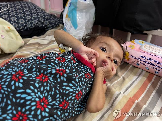 '가자지구서 영양실조 겪는 2살 여아' [로이터 연합뉴스 자료사진. 재판매 및 DB 금지]