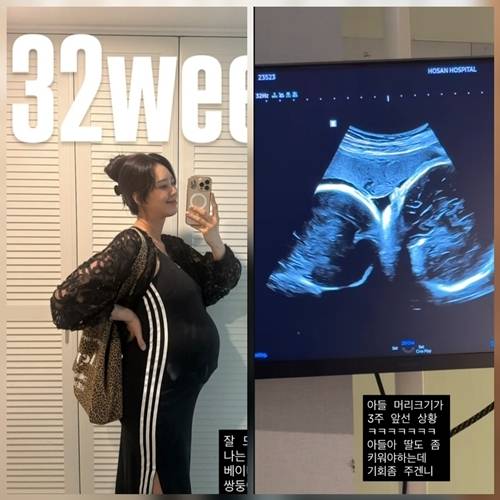 배우 지소연이 임신 중인 쌍둥이의 근황을 전하며 일상을 공유했다. 사진=SNS