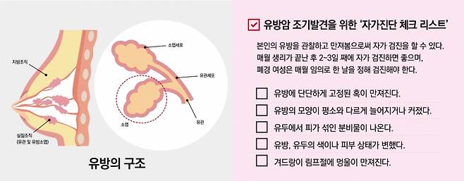 유방의 구조와 유방암 조기발견을 위한 '자가진단 체크 리스트'. /자료= 순천향대 부천병원