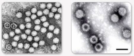 수족구병을 일으키는 장바이러스를 전자현미경으로 관찰한 사진. /자료=국가건강정보포털