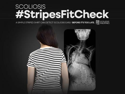 올해 부산국제마케팅광고제 공익 부문 대상을 받은 필리핀의 ‘척추 측만증 #줄무늬 티셔츠로 체크해’ 광고. 매드스타즈 제공