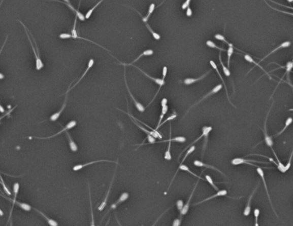 채취한 돼지 액상정액. 농촌진흥청