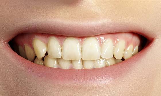 치아 변색 예방을 위해서는 색소가 강한 음식과 음료를 줄이는 것이 가장 좋다.​/사진=클립아트코리아