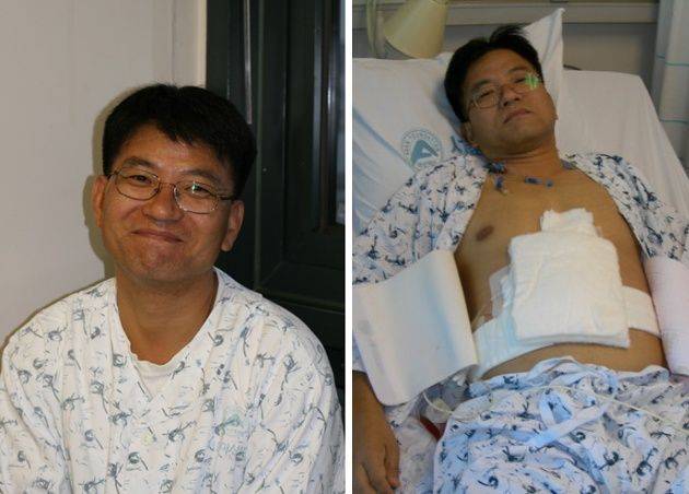 2005년 간기증 수술 당시 이태조 목사의 모습. 이 목사 제공