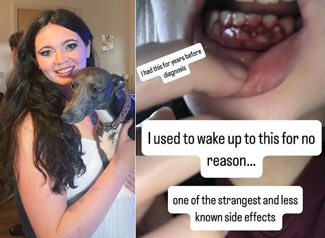 백혈병을 진단받은 앰버 커닝햄 로건. 사진=더선