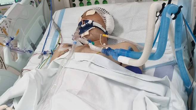 안태랑씨가 포신에 얼굴이 끼이는 사고를 당한 후 병원에 입원해 있다. ⓒTAERANI 유튜브 캡쳐