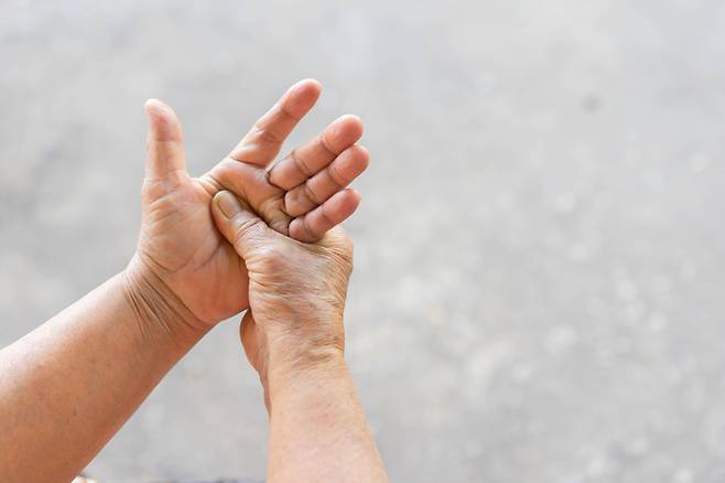 통풍 발병의 주요 원인이 음주나 잘못된 식습관이 아니라 유전적 요인이라는 연구 결과가 나왔다. 사진=게티이미지