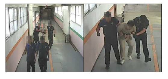 고의적인 '비녀꺾기'로 의심되는 상황. 사진 인권위