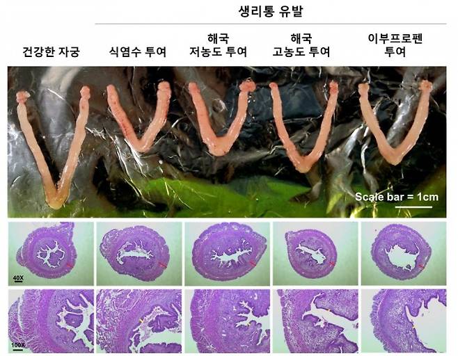 동물실험 결과 해국 추출물 투여군은 자궁 수축이 완화돼 정상에 가까운 형태를 회복했다. 한의학연 제공.