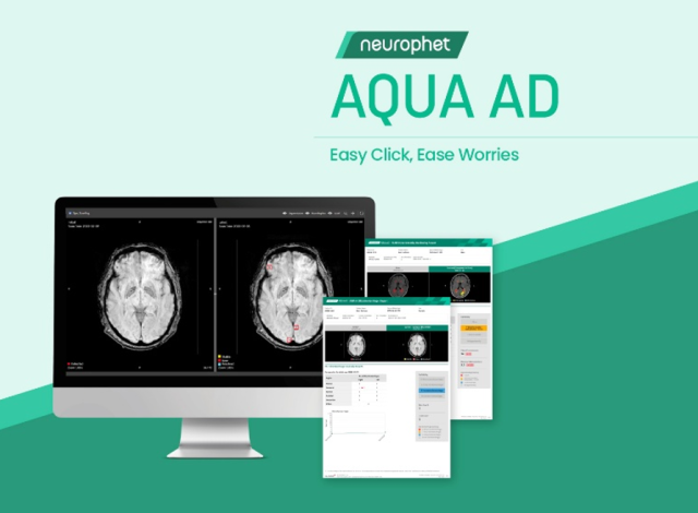 뉴로핏의 뇌 영상 검출·진단 보조 소프트웨어 ‘뉴로핏 아쿠아 AD 플러스’. 사진 제공=뉴로핏