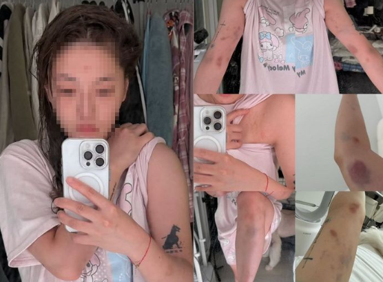 자신의 SNS를 통해 피해 사실을 공개한 대만 유튜버 류리잉. 사진=인스타그램 캡쳐