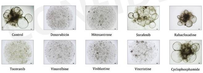 다양한 항암제에 대한 오가노이드 감수성 검사 예시(포도테라퓨틱스 제공) ⓒ 뉴스1