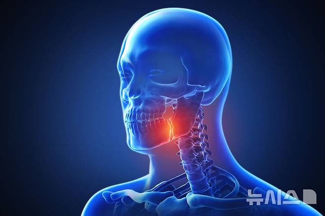 [서울=뉴시스] 턱관절 장애는 턱관절과 그 주변 근육, 인대에서 발생하는 통증이나 기능 이상을 말한다. (사진= 유토이미지 제공)