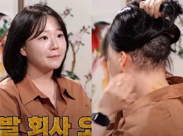 ‘양털모발증후군’을 가지고 태어나 29년째 가발을 착용해 온 여성의 사연이 공개됐다./사진=KBS Joy ‘무엇이든 물어보살’ 방송 화면 캡처