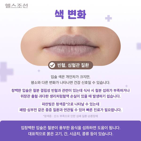 사진=헬스조선DB