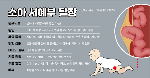 소아 서혜부 탈장의 특성. 사진 제공=한양대병원