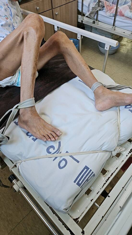 부천 이룸병원에 입원한 환자의 발이 묶여 있다. 제보자 제공