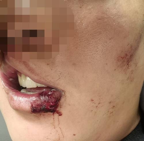 체포 과정에서 다친 얼굴 [독자 제공. 재판매 및 DB 금지]